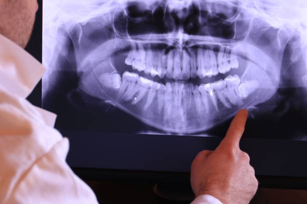 Best Dentist for Tooth Abscess  in Yountville, CA