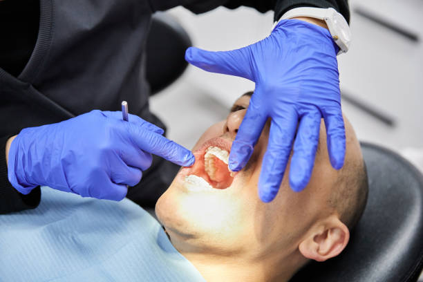 Best Emergency Dentist Near Me  in Yountville, CA