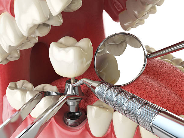 Best Tooth Pain Emergency Relief  in Yountville, CA
